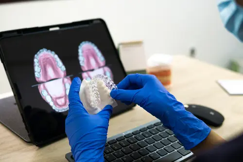 Digital Impression Integration