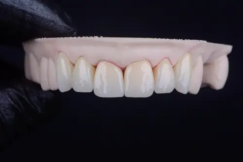 Monolithic and Layered Zirconia