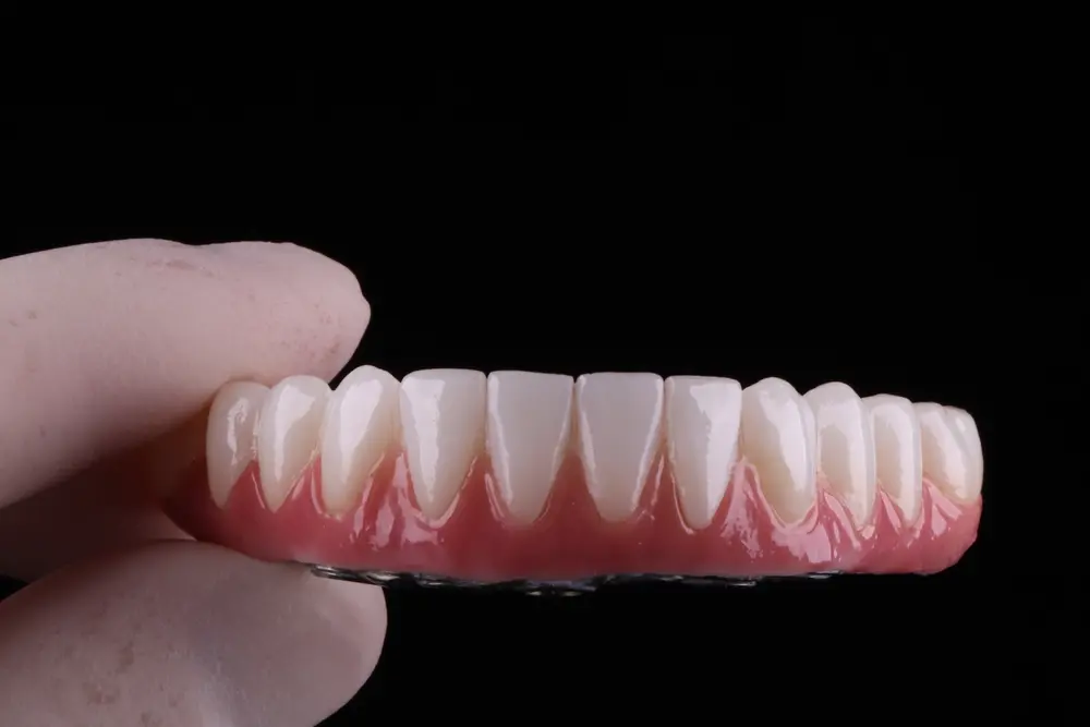Porcelain-Fused-to-Metal (PFMs)