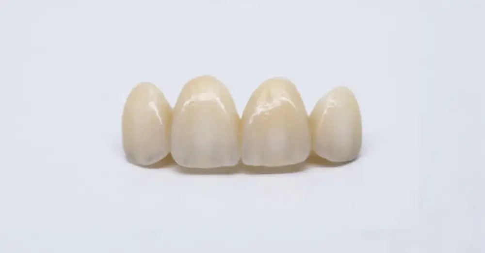 Translucent Zirconia