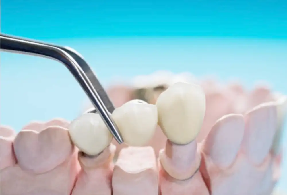 Dental Teeth