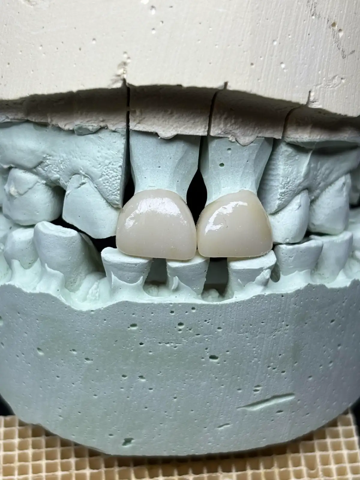 More Dental Work